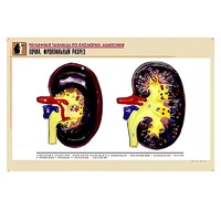 Рельефная таблица "Почка. Фронтальный разрез" (формат А1, матовое ламинир.) - «globural.ru» - Москва
